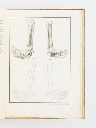 MEMORIA CHIRURGICA SUI PIEDI TORTI CONGENITI DEI FANCIULLI E SULLA MANIERA DI CORREGGERE QUESTA DEFORMITA DI ANTONIO SCARPA.