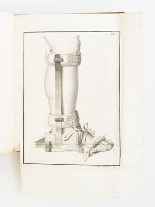 MEMORIA CHIRURGICA SUI PIEDI TORTI CONGENITI DEI FANCIULLI E SULLA MANIERA DI CORREGGERE QUESTA DEFORMITA DI ANTONIO SCARPA.