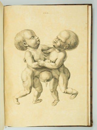 MUSEUM ANATOMICUM ACADAMIAE LUGDUNO-BATAVAE. BIRTH DEFECTS ANATOMY - 18TH CENTURY, EDUARD SANDIFORT.
