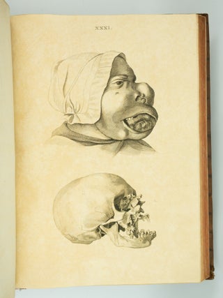 MUSEUM ANATOMICUM ACADAMIAE LUGDUNO-BATAVAE.