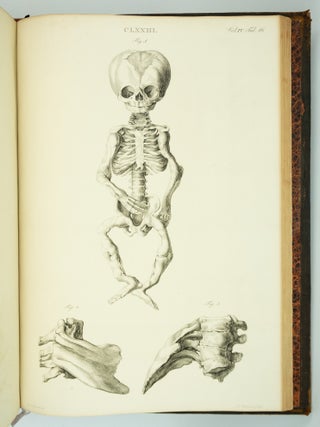 MUSEUM ANATOMICUM ACADAMIAE LUGDUNO-BATAVAE.