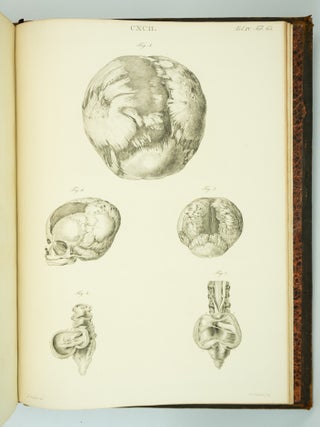 MUSEUM ANATOMICUM ACADAMIAE LUGDUNO-BATAVAE.