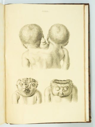 MUSEUM ANATOMICUM ACADAMIAE LUGDUNO-BATAVAE.