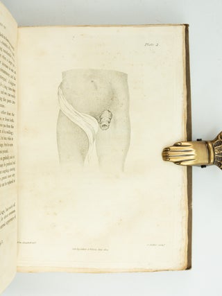 A TREATISE ON RUPTURES, CONTAINING AN ANATOMICAL DESCRIPTION OF EACH SPECIES, WITH AN ACCOUNT OF ITS SYMPTOMS, PROGRESS, AND TREATMENT.