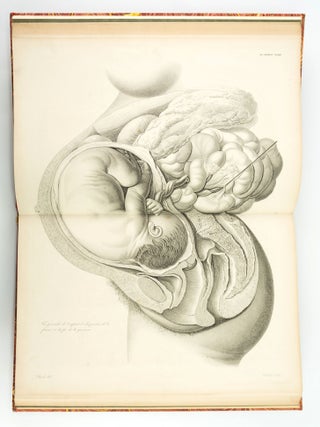 ATLAS FOR NOUVELLES DÉMONSTRATIONS D'ACCOUCHEMENTS.