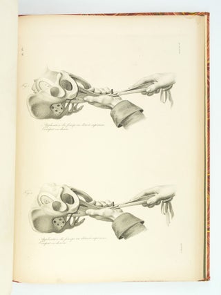 ATLAS FOR NOUVELLES DÉMONSTRATIONS D'ACCOUCHEMENTS.