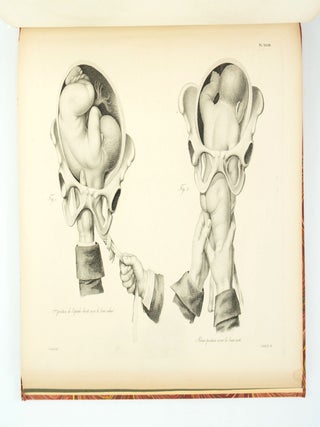 ATLAS FOR NOUVELLES DÉMONSTRATIONS D'ACCOUCHEMENTS.