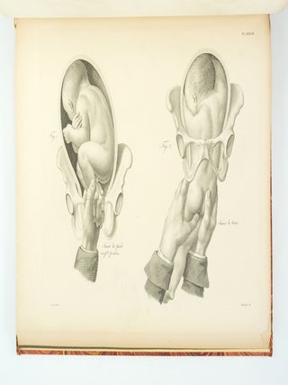 ATLAS FOR NOUVELLES DÉMONSTRATIONS D'ACCOUCHEMENTS.