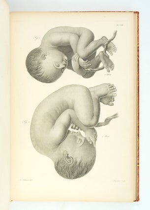 ATLAS FOR NOUVELLES DÉMONSTRATIONS D'ACCOUCHEMENTS.