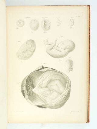 ATLAS FOR NOUVELLES DÉMONSTRATIONS D'ACCOUCHEMENTS.